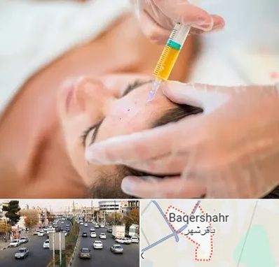 پی آر پی در باقرشهر