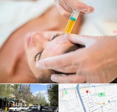 پی آر پی در کوی فیروز تبریز