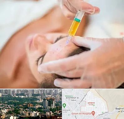 پی آر پی در عظیمیه کرج 