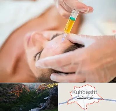 پی آر پی در کوهدشت