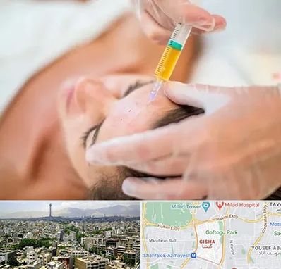 پی آر پی در گیشا 