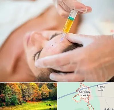 پی آر پی در کردکوی