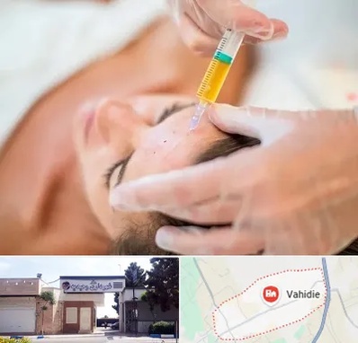 پی آر پی در وحیدیه شهریار