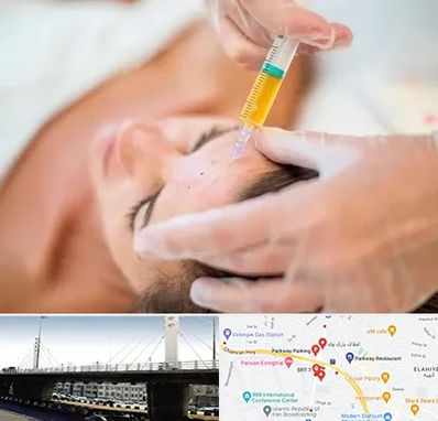 پی آر پی در پارک وی 