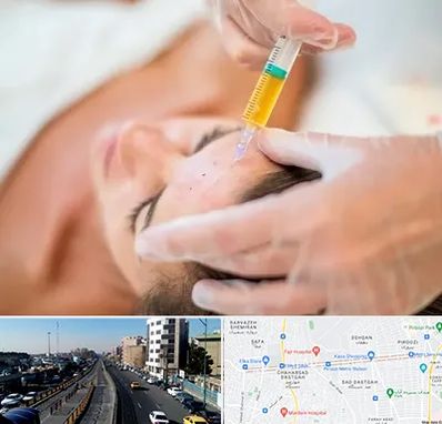 پی آر پی در پیروزی 