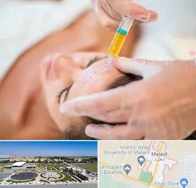 پی آر پی در ملارد