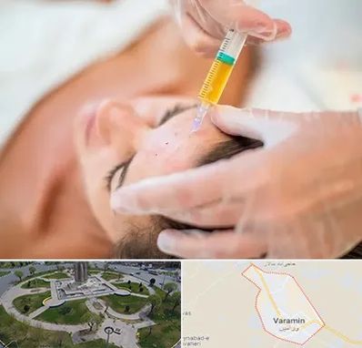 پی آر پی در ورامین