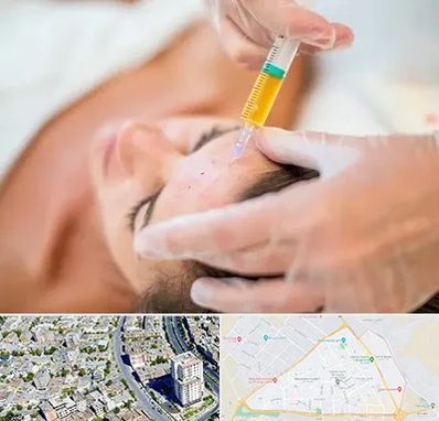 پی آر پی در قاسم آباد مشهد 