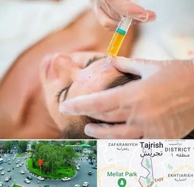 پی آر پی در تجریش 