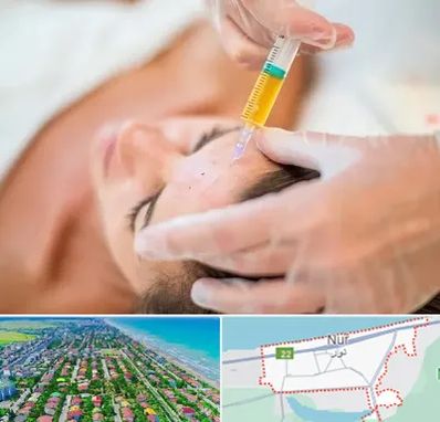 پی آر پی در نور