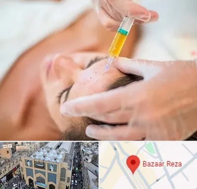 پی آر پی در بازار رضا مشهد