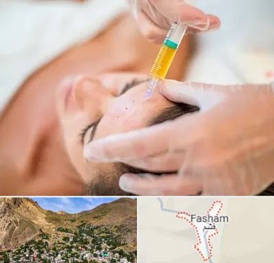 پی آر پی در فشم