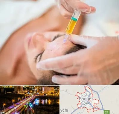 پی آر پی در سقز