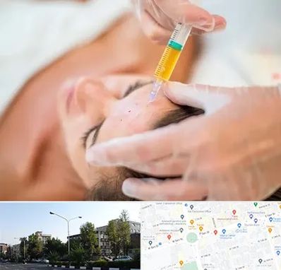 پی آر پی در میدان کاج 