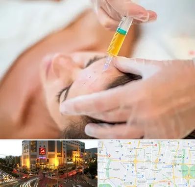 پی آر پی در جنت آباد تهران 