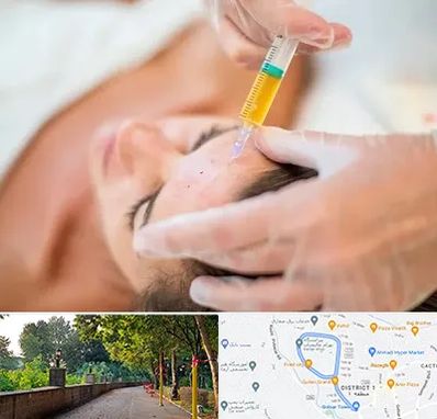 پی آر پی در بلوار گیلان رشت