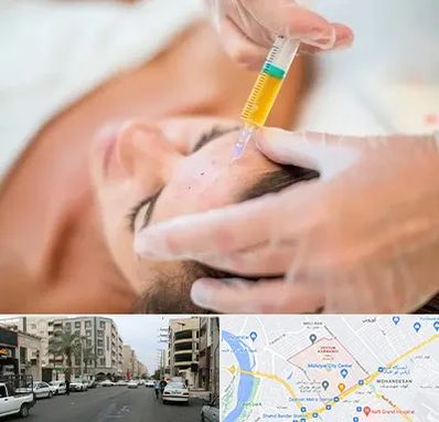 پی آر پی در زیتون کارمندی اهواز