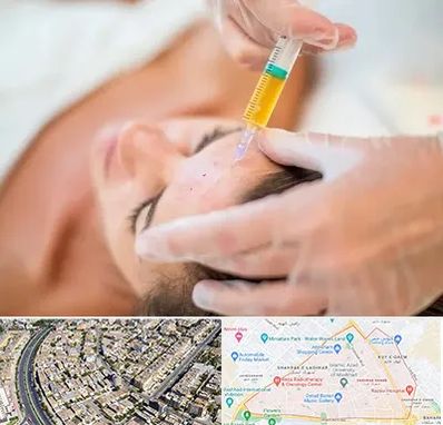 پی آر پی در شهرک غرب مشهد