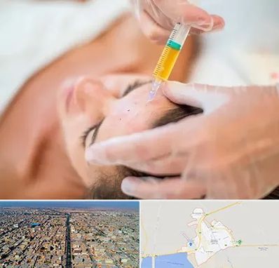 پی آر پی در بندر ماهشهر