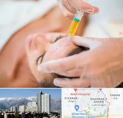 پی آر پی در شهرک غرب 