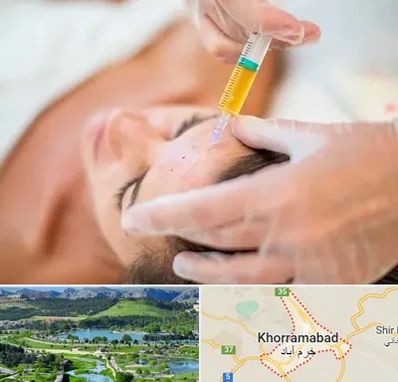 پی آر پی در خرم آباد