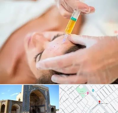 پی آر پی در مصلی مشهد