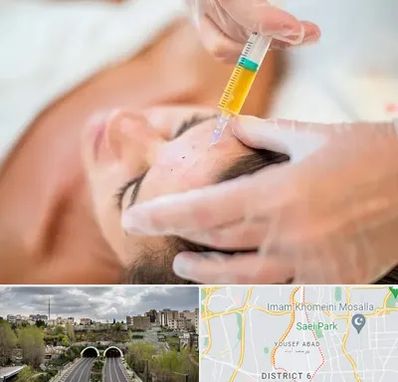 پی آر پی در یوسف آباد 