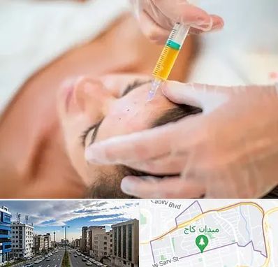 پی آر پی در سعادت آباد 