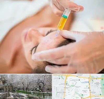 پی آر پی در باغ فیض