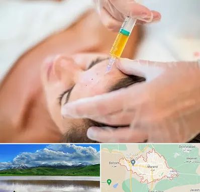 پی آر پی در مرند