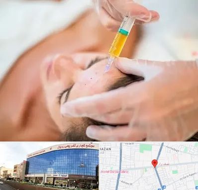 پی آر پی در نصف راه تبریز