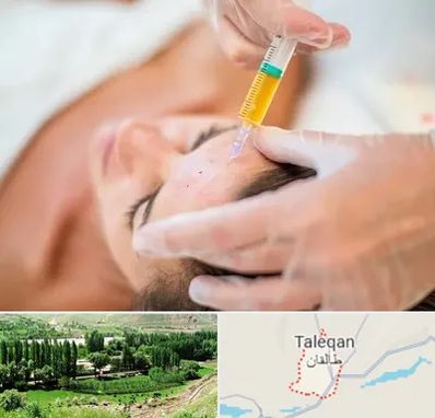 پی آر پی در طالقان