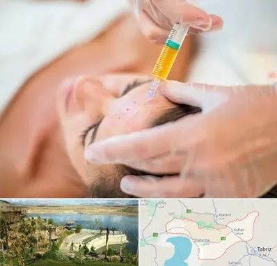 پی آر پی در شبستر