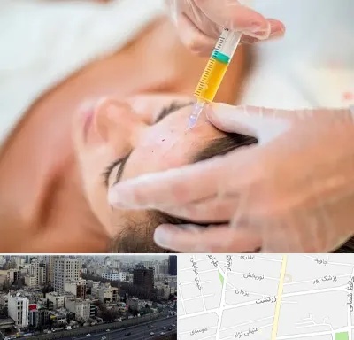 پی آر پی در زرتشت