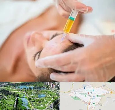 پی آر پی در بجنورد