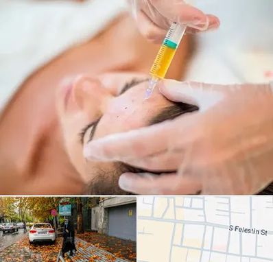 پی آر پی در خیابان فلسطین