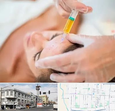 پی آر پی در 17شهریور