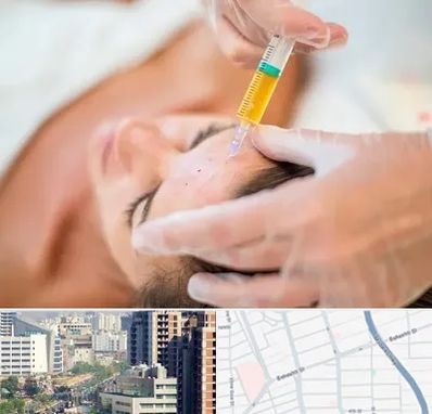 پی آر پی در خیابان بهشتی