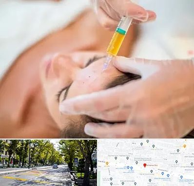 پی آر پی در میرداماد 