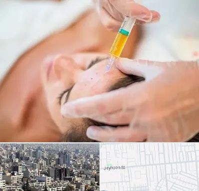 پی آر پی در جیحون