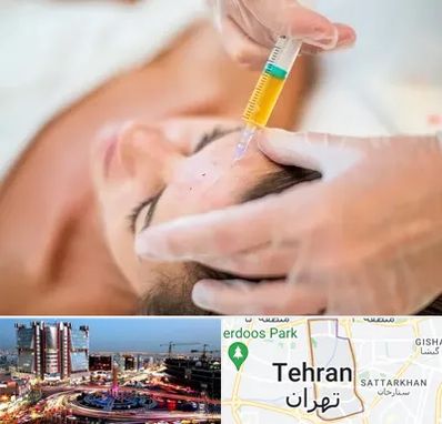 پی آر پی در صادقیه 