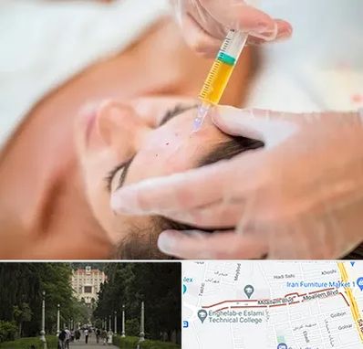 پی آر پی در بلوار معلم رشت 