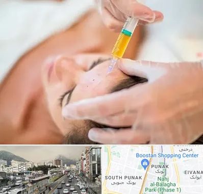 پی آر پی در پونک 