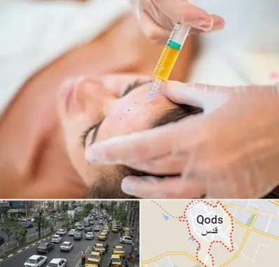 پی آر پی در شهر قدس