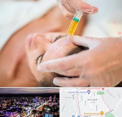 پی آر پی در گلسار رشت 