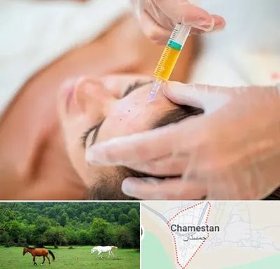 پی آر پی در چمستان