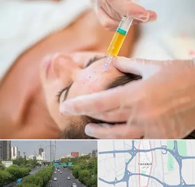 پی آر پی در توانیر