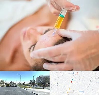 پی آر پی در بلوار کلاهدوز مشهد