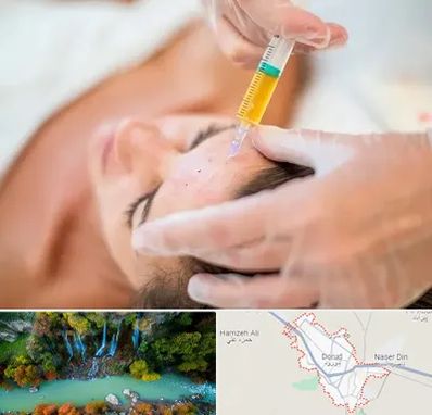 پی آر پی در دورود