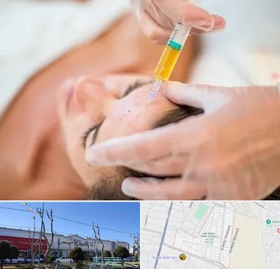 پی آر پی در فاز دو اندیشه
